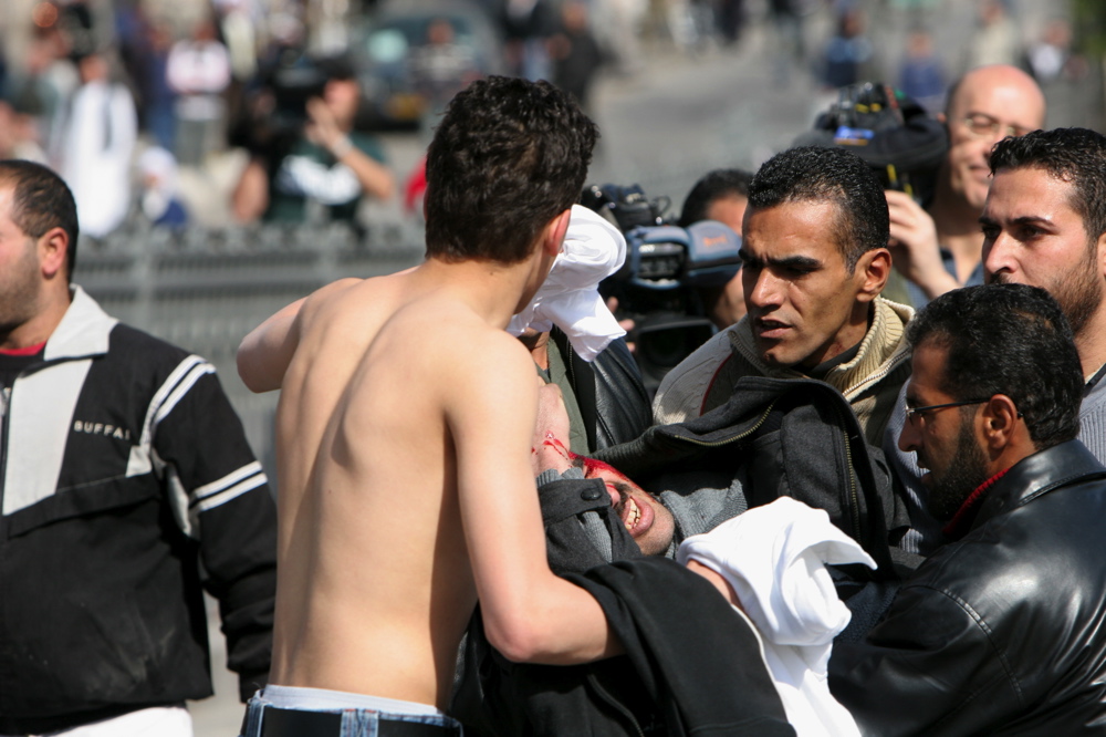 Young Palestinian  man and wounded, feb 9 07 02